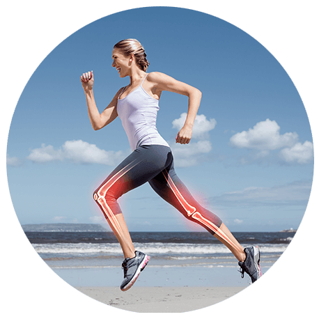 Eine Frau läuft am Strand. In Ihren Beinen sind Knochen abgebildet.