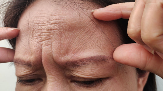 Nahaufnahme der Stirn einer Person mit sichtbaren Falten, die ihre Haut mit den Fingern nach oben zieht.