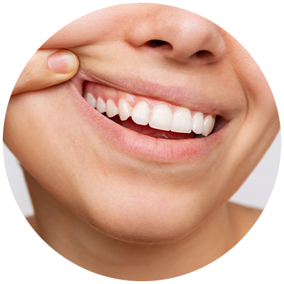 Nahaufnahme eines Frauengesichtes mit Obergebiss aus weißen Zähnen und gesundem Zahnfleisch