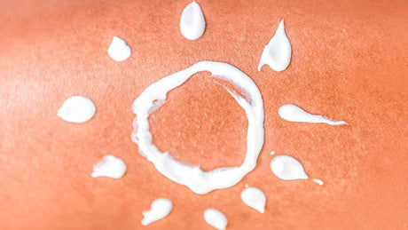 Nahaufnahme von einer menschlichen Hautfläche sichtlich  mit Sonnenbrand. Mit Sonnencreme wurde eine Sonne mit Sonnenstrahlen draufgemalt