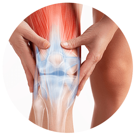 Abbildung von einem Knie mit Sehnen und Muskeln. Hände fassen das Knie an