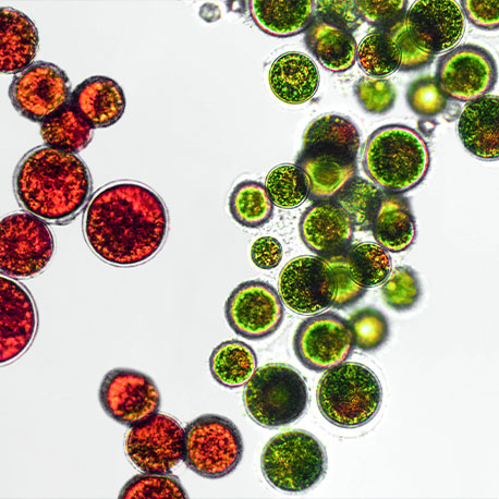 Aufnahme mit dem Mikroskop von der Grünalge Haematococcus pluvialis